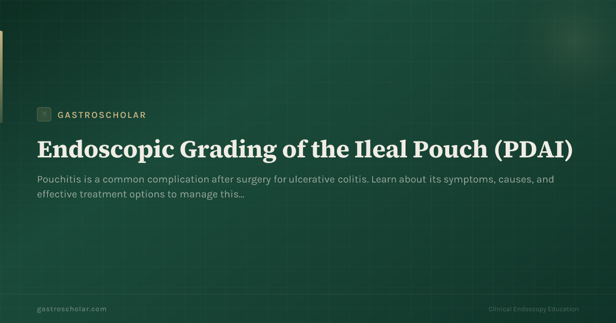 Original GastroScholar summary card for pouchitis after IPAA. Not an endoscopic photograph.