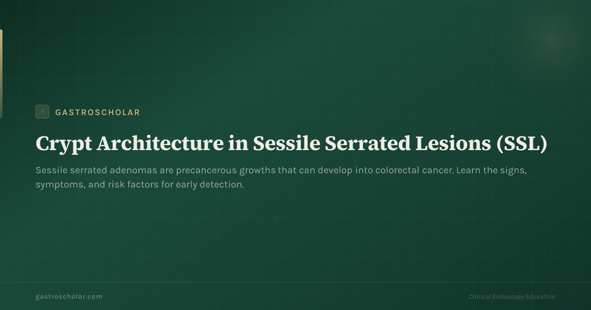 Original GastroScholar summary card for sessile serrated lesions. Not an endoscopic photograph.